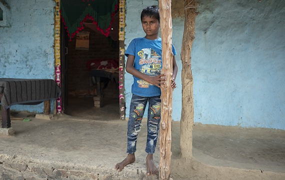 7-year-old Aanand from rural Nepal is blinded by cataracts.