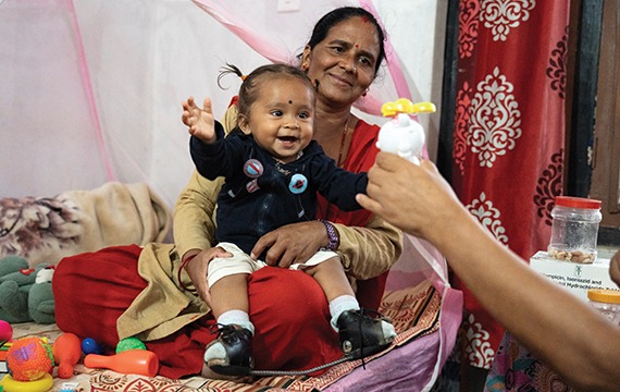 Help children like 1-year-old Mausam in Nepal receive life-changing surgery and rehabilitation for clubfoot.
