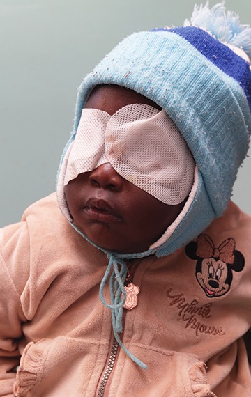Nadiah in Zimbabwe received sight-saving cataract surgery to give her a brighter future.