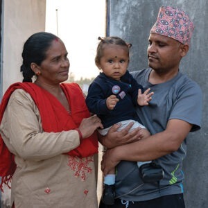 Help children like 1-year-old Mausam in Nepal receive life-changing surgery and rehabilitation for clubfoot.