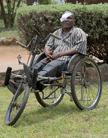 Rodgers received sight-saving cataract surgery at a cbm-funded hospital in Zimbabwe.