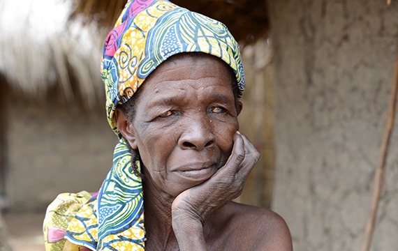 Rakiya in Nigeria is blind from River Blindness and walks with a stick to guide her through the village.