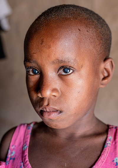 Child Sponsorship. 7-year-old Rita from Uganda needs sight-saving surgery to remove her cloudy cataracts.