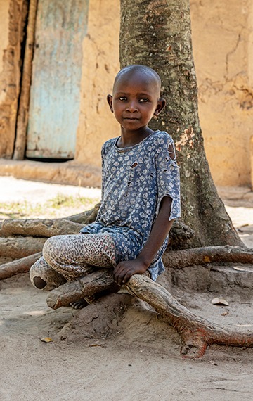 6-year-old Faith from rural Uganda is blinded by cloudy cataracts.