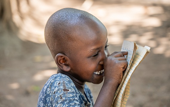 6-year-old Faith from rural Uganda is blinded by cloudy cataracts.