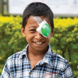 Samarapan in Nepal received sight-saving cataract surgery at a cbm-funded hospital.